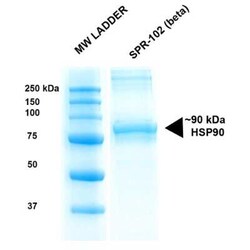 Novus Biologicals™ Recombinant Human HSP90 beta Protein